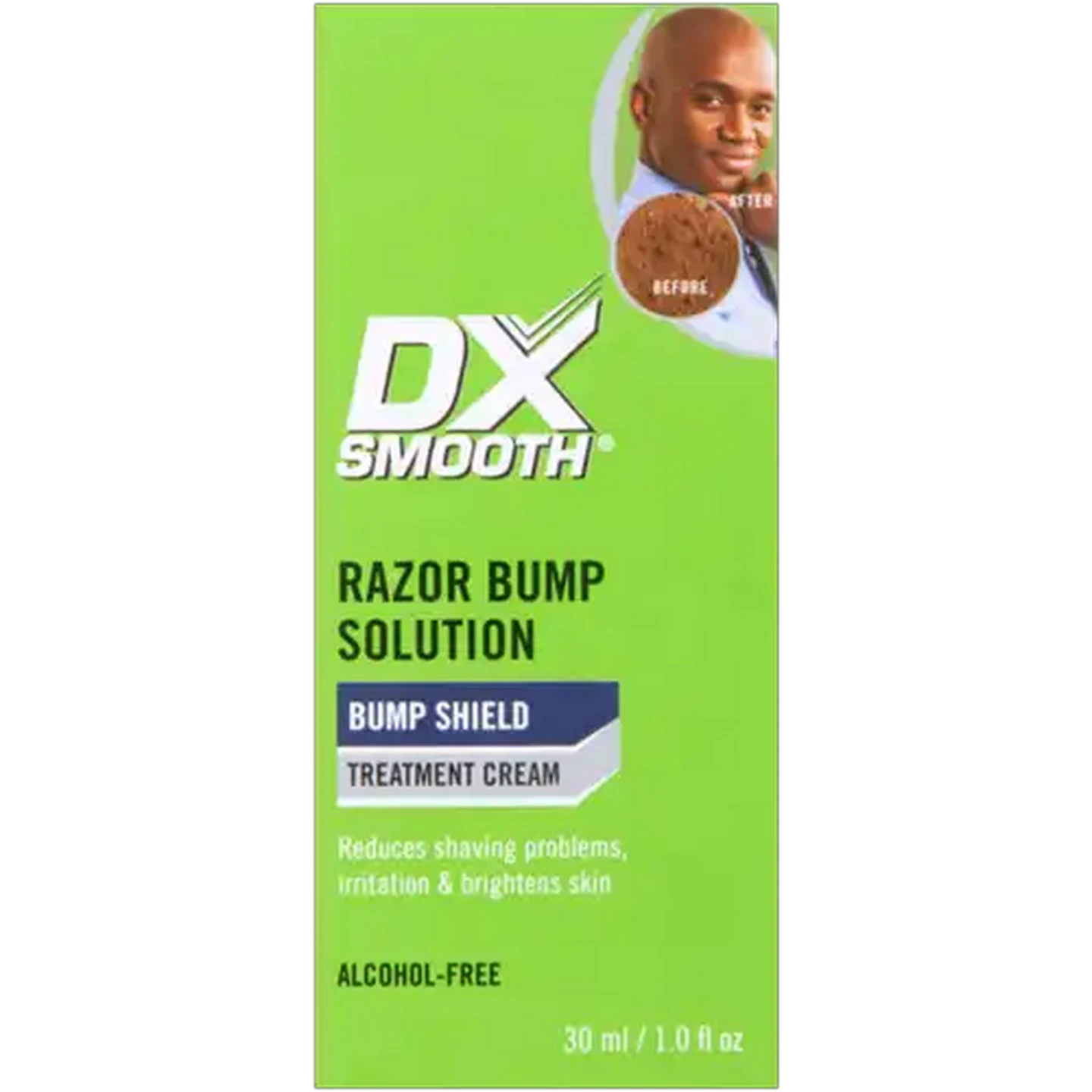 Image of DX Smooth Bump Shield Razor Bump Solution Treatment Cream 30ml