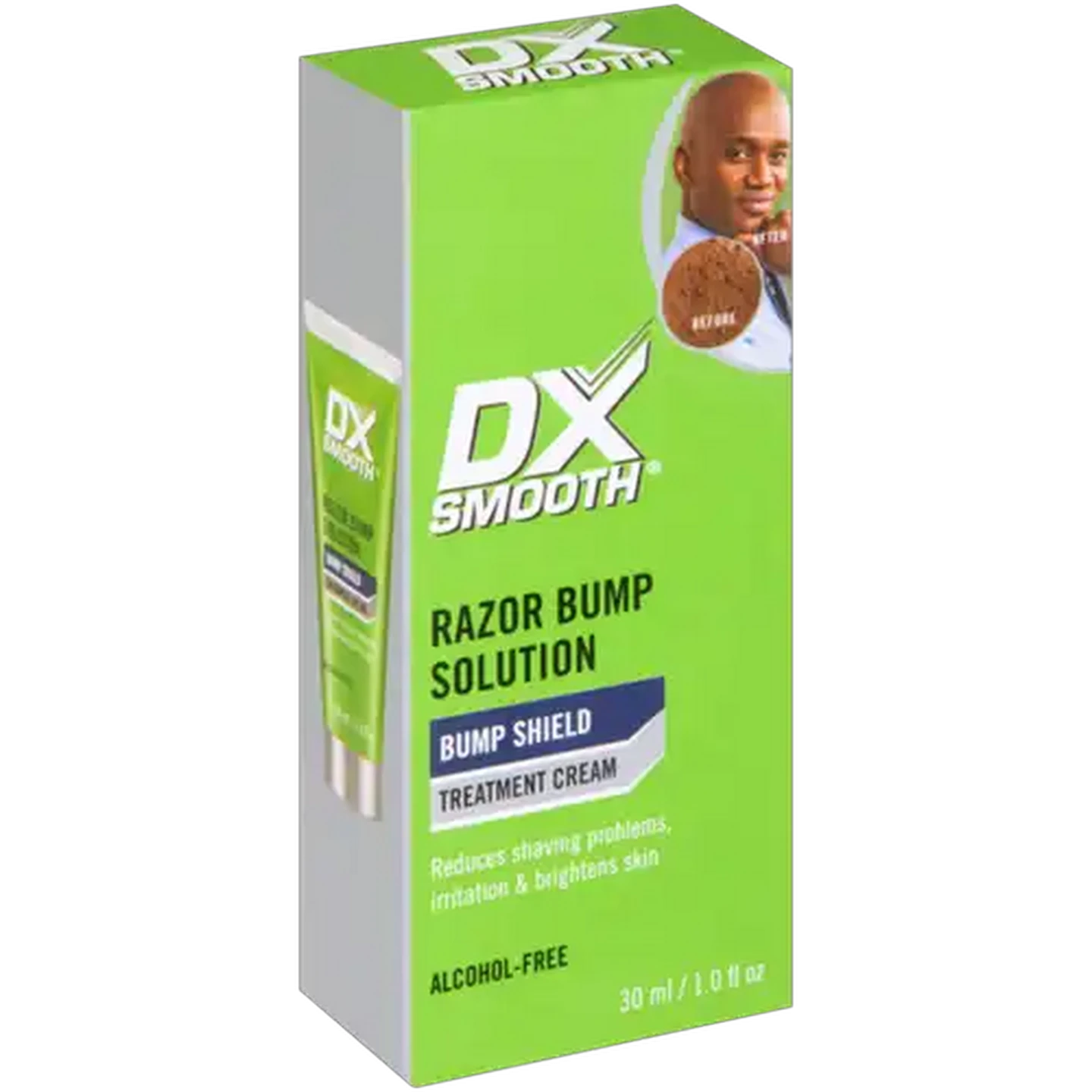 Image of DX Smooth Bump Shield Razor Bump Solution Treatment Cream 30ml